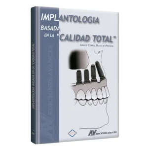 Implantología Basada en la Calidad Total