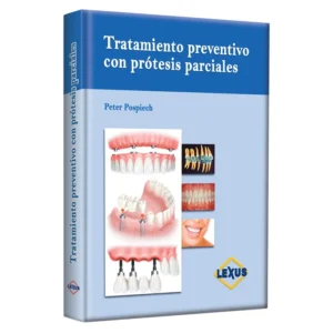 Tratamiento preventivo con prótesis parciales